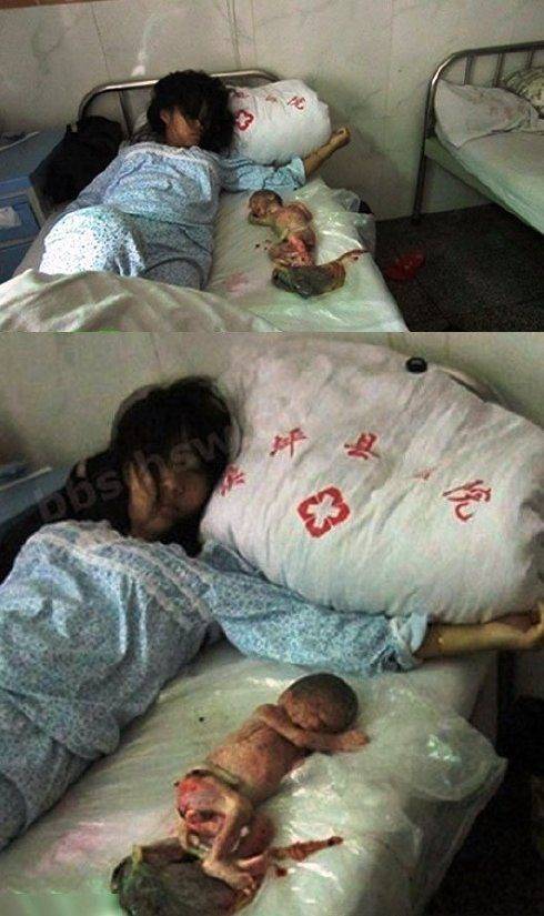 Mulher chinesa é forçada a abortar aos 7 meses, e obrigada a dormir com o feto! (5)