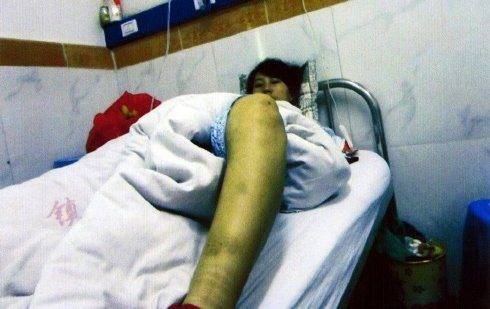 Mulher chinesa é forçada a abortar aos 7 meses, e obrigada a dormir com o feto! (7)
