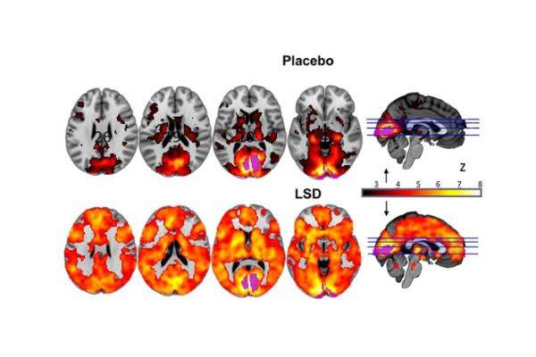 Como funciona um cérebro sob efeito de LSD