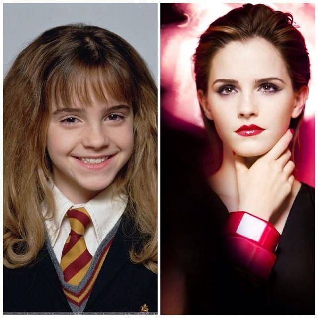 Celebridades que eram feias - Emma Watson