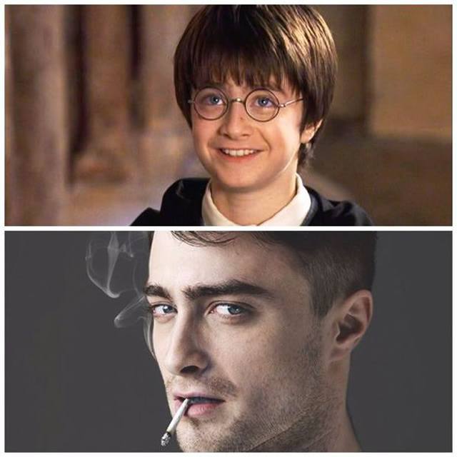 Celebridades que eram feias - Daniel Radcliffe