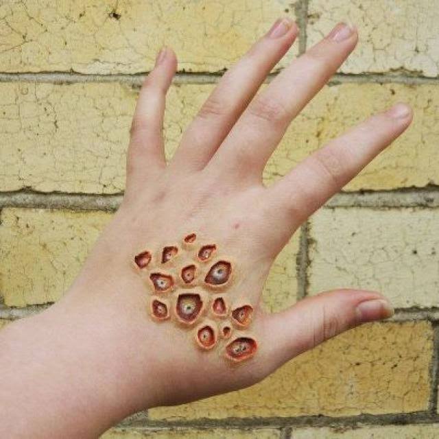 Tripofobia
