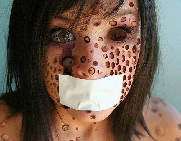 Tripofobia