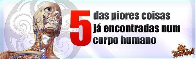 5 das piores coisas já encontradas num corpo humano