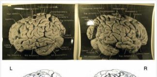 Novo estudo mostra que o cérebro de Einstein era diferente